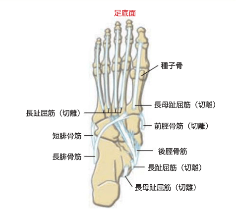 クロスサポートの画像